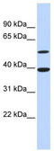 Cyclic AMP-dependent transcription factor ATF-7 antibody, TA330084, Origene, Western Blot image 