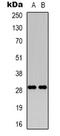 Rah1 antibody, LS-C368783, Lifespan Biosciences, Western Blot image 