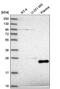 TATA-Box Binding Protein Associated Factor 11 antibody, NBP2-55367, Novus Biologicals, Western Blot image 