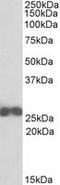 Rho-GDI beta antibody, LS-C139611, Lifespan Biosciences, Western Blot image 