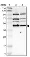 Inositol Monophosphatase Domain Containing 1 antibody, PA5-52667, Invitrogen Antibodies, Western Blot image 