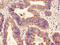 Homeodomain Interacting Protein Kinase 3 antibody, LS-C671550, Lifespan Biosciences, Immunohistochemistry paraffin image 