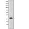 Folate Receptor Beta antibody, abx215436, Abbexa, Western Blot image 