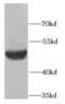 Serpin Family A Member 10 antibody, FNab07739, FineTest, Western Blot image 