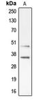 Cyclin Dependent Kinase 10 antibody, LS-C353066, Lifespan Biosciences, Western Blot image 