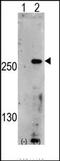Phosphoinositide Kinase, FYVE-Type Zinc Finger Containing antibody, AP13825PU-N, Origene, Western Blot image 
