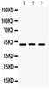 Bone Morphogenetic Protein 5 antibody, PA5-78878, Invitrogen Antibodies, Western Blot image 