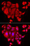 Solute Carrier Family 26 Member 2 antibody, abx004869, Abbexa, Western Blot image 
