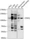 Diacylglycerol Kinase Theta antibody, 19-175, ProSci, Western Blot image 