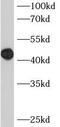 BAF Chromatin Remodeling Complex Subunit BCL7B antibody, FNab00850, FineTest, Western Blot image 