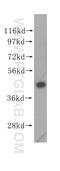 Eukaryotic Translation Initiation Factor 4A2 antibody, 11280-1-AP, Proteintech Group, Western Blot image 