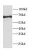 Calcium Voltage-Gated Channel Auxiliary Subunit Beta 1 antibody, FNab01174, FineTest, Western Blot image 