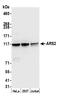 Serrate RNA effector molecule homolog antibody, A304-550A, Bethyl Labs, Western Blot image 