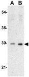 Tumor Protein P53 Inducible Nuclear Protein 1 antibody, GTX31278, GeneTex, Western Blot image 