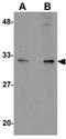 Alpha-ketoglutarate-dependent dioxygenase alkB homolog 2 antibody, GTX85166, GeneTex, Western Blot image 