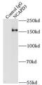Condensin-2 complex subunit D3 antibody, FNab05577, FineTest, Immunoprecipitation image 