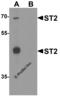Interleukin 1 Receptor Like 1 antibody, 3363, ProSci Inc, Western Blot image 