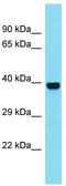 Inactive N-acetylated-alpha-linked acidic dipeptidase-like protein 2 antibody, TA334334, Origene, Western Blot image 