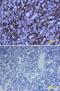 Growth Hormone 1 antibody, BAF1566, R&D Systems, Western Blot image 