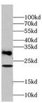 Transmembrane Protein 176B antibody, FNab08762, FineTest, Western Blot image 