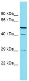 Calcium-binding protein 4 antibody, TA343346, Origene, Western Blot image 