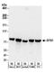 Glycogen Synthase 1 antibody, A304-238A, Bethyl Labs, Western Blot image 