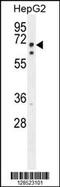 Lipase Maturation Factor 2 antibody, 55-497, ProSci, Western Blot image 