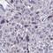 Nucleoporin 133 antibody, HPA059767, Atlas Antibodies, Immunohistochemistry paraffin image 