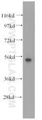 Keratin 7 antibody, 16857-1-AP, Proteintech Group, Western Blot image 