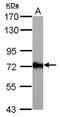 Acyl-CoA Synthetase Long Chain Family Member 6 antibody, PA5-30465, Invitrogen Antibodies, Western Blot image 