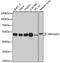 Rho GTPase Activating Protein 1 antibody, 19-143, ProSci, Western Blot image 