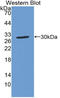Copper Chaperone For Superoxide Dismutase antibody, LS-C314556, Lifespan Biosciences, Western Blot image 