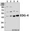 Lysophosphatidic Acid Receptor 2 antibody, A05435-1, Boster Biological Technology, Western Blot image 