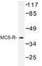 Melanocortin 5 Receptor antibody, AP01320PU-N, Origene, Western Blot image 