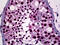 Neurogenic differentiation factor 1 antibody, 51-773, ProSci, Immunohistochemistry paraffin image 
