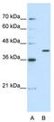 Exoribonuclease 1 antibody, TA344014, Origene, Western Blot image 