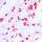 RB Transcriptional Corepressor 1 antibody, LS-C352779, Lifespan Biosciences, Immunohistochemistry frozen image 