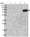 TatD DNase Domain Containing 2 antibody, PA5-57833, Invitrogen Antibodies, Western Blot image 