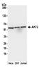 RAC-beta serine/threonine-protein kinase antibody, A302-209A, Bethyl Labs, Western Blot image 
