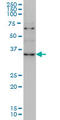 Zinc finger protein ZIC 4 antibody, LS-C105187, Lifespan Biosciences, Western Blot image 