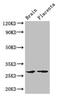 F-Box And Leucine Rich Repeat Protein 22 antibody, CSB-PA757543LA01HU, Cusabio, Western Blot image 