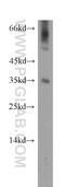 Docking Protein 5 antibody, 11948-1-AP, Proteintech Group, Western Blot image 