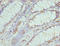 Cytidine/Uridine Monophosphate Kinase 1 antibody, LS-C675551, Lifespan Biosciences, Immunohistochemistry paraffin image 