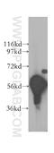 Dual specificity tyrosine-phosphorylation-regulated kinase 1B antibody, 12240-1-AP, Proteintech Group, Western Blot image 