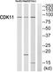 Cyclin-dependent kinase 11 antibody, PA5-38829, Invitrogen Antibodies, Western Blot image 
