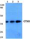 Cathepsin K antibody, PA5-75741, Invitrogen Antibodies, Western Blot image 