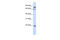 SUMO Specific Peptidase 1 antibody, 26-966, ProSci, Western Blot image 