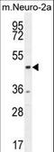 C-Terminal Binding Protein 1 antibody, LS-C167117, Lifespan Biosciences, Western Blot image 