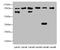 Catenin Beta 1 antibody, A51457-100, Epigentek, Western Blot image 