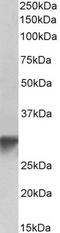 Golgi Phosphoprotein 3 antibody, TA326322, Origene, Western Blot image 